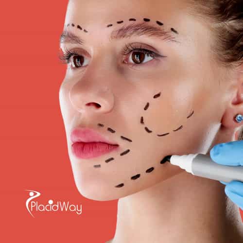 Facelift Surgery in Colombia for Puerto Rican Patients: Transform Your Look with Expert Surgeons